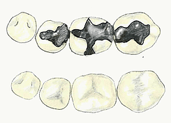 dental filling for Clinton and Roy UT